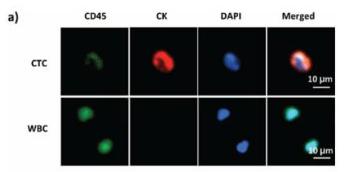 循環腫瘤細胞（circulating tumour cell）